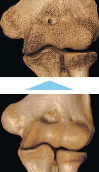 画像が削除されました
